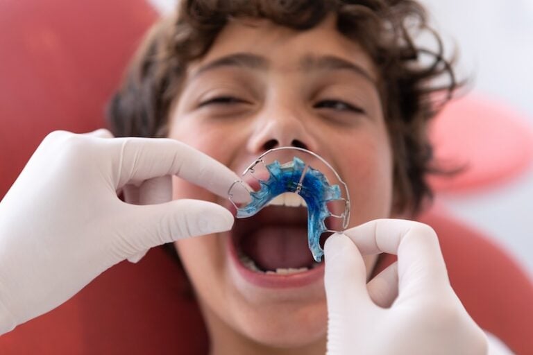 Retainer going into an ortho patient's mouth which drives patient lifetime value